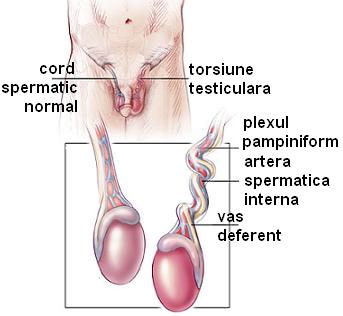 Torsiune testiculara